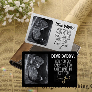 Custom Metal Ultrasound Picture Wallet Card,Perfect for New Baby Sonogram,Pregnancy Keepsake,new Dad,Baby Shower Present,Father's Day Gift