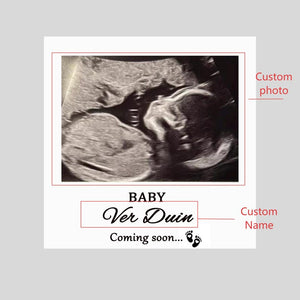 Personalised Ultrasound Building blocks,Baby Scan Photo Building Block,PuzzleDecor,Building blocks,Gifts for New Daddy,Father's Day Gift
