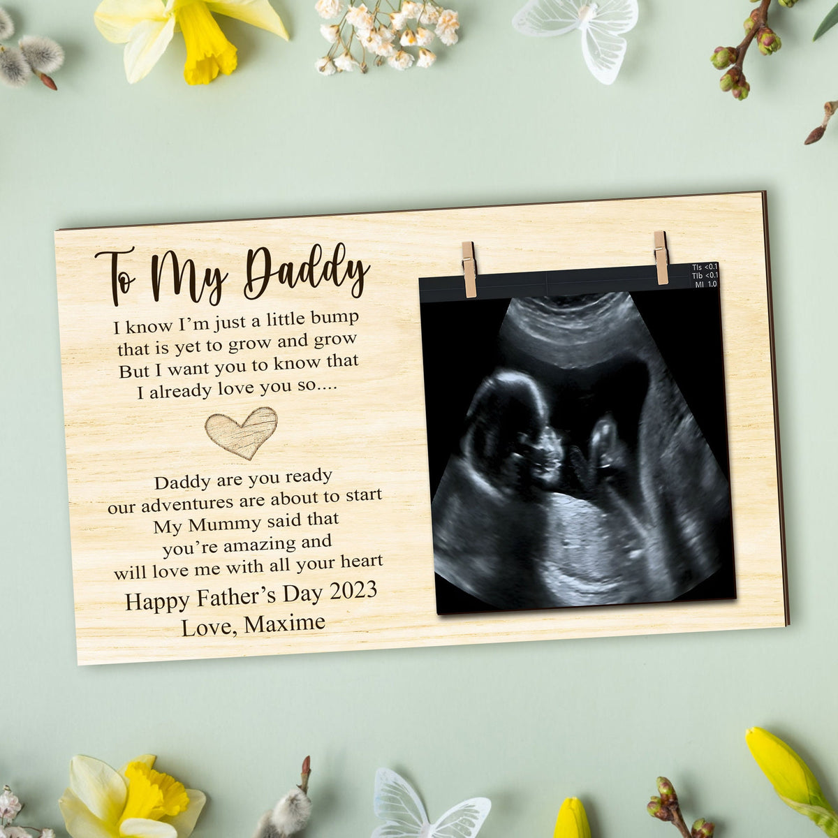 Customized Daddy To Be Frame, Happy Fathers Day Sign, New Dad Gift,Ultrasound Picture Frame, Fathers Day Gift, Gift For Daddy 1st Father Day