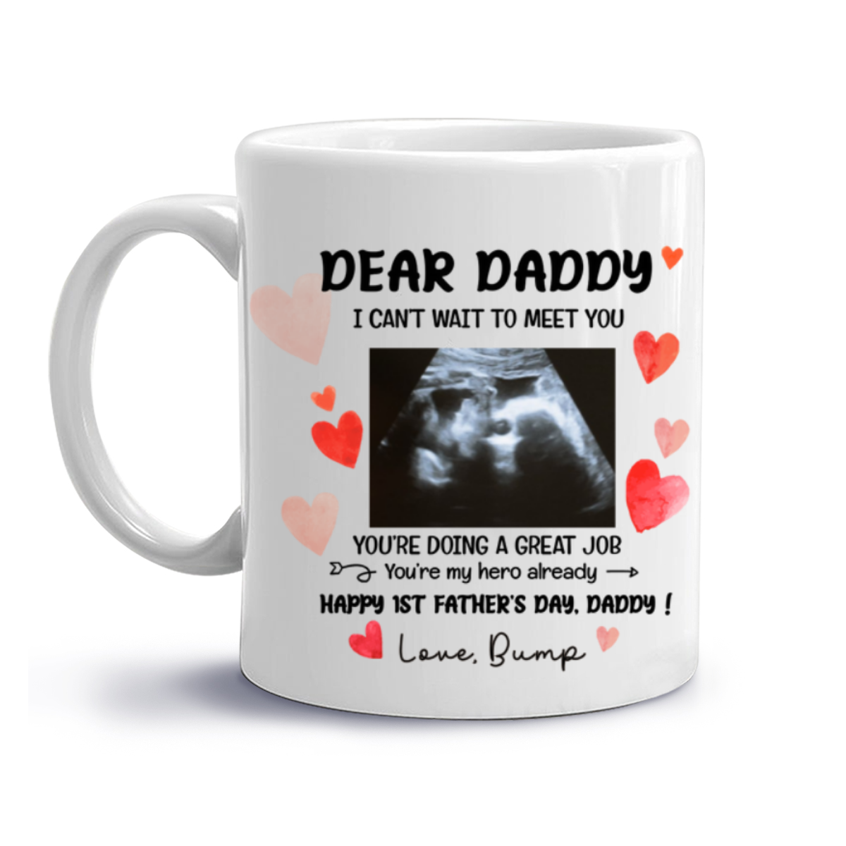 Happy 1st Father s Day Daddy I Can t Wait To Meet You Mug, Father s Day Gift Gift From Unborn Baby, Baby Scan Photo Mug, Expecting Dad Gift